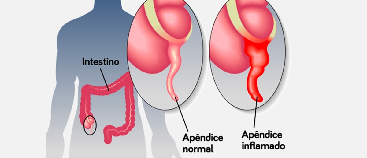 Quadrantes Abdominais